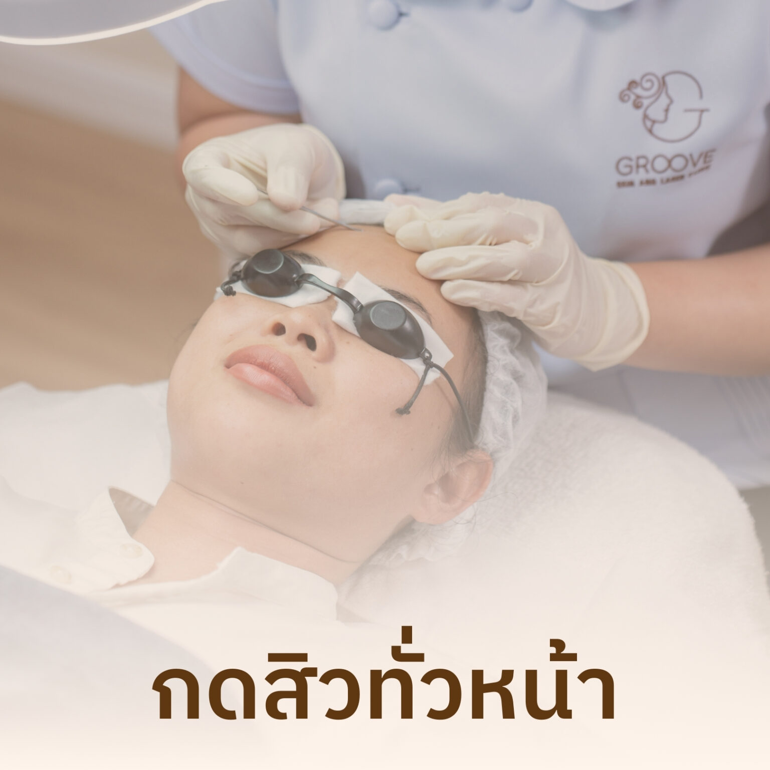 กดสิวทั่วหน้า