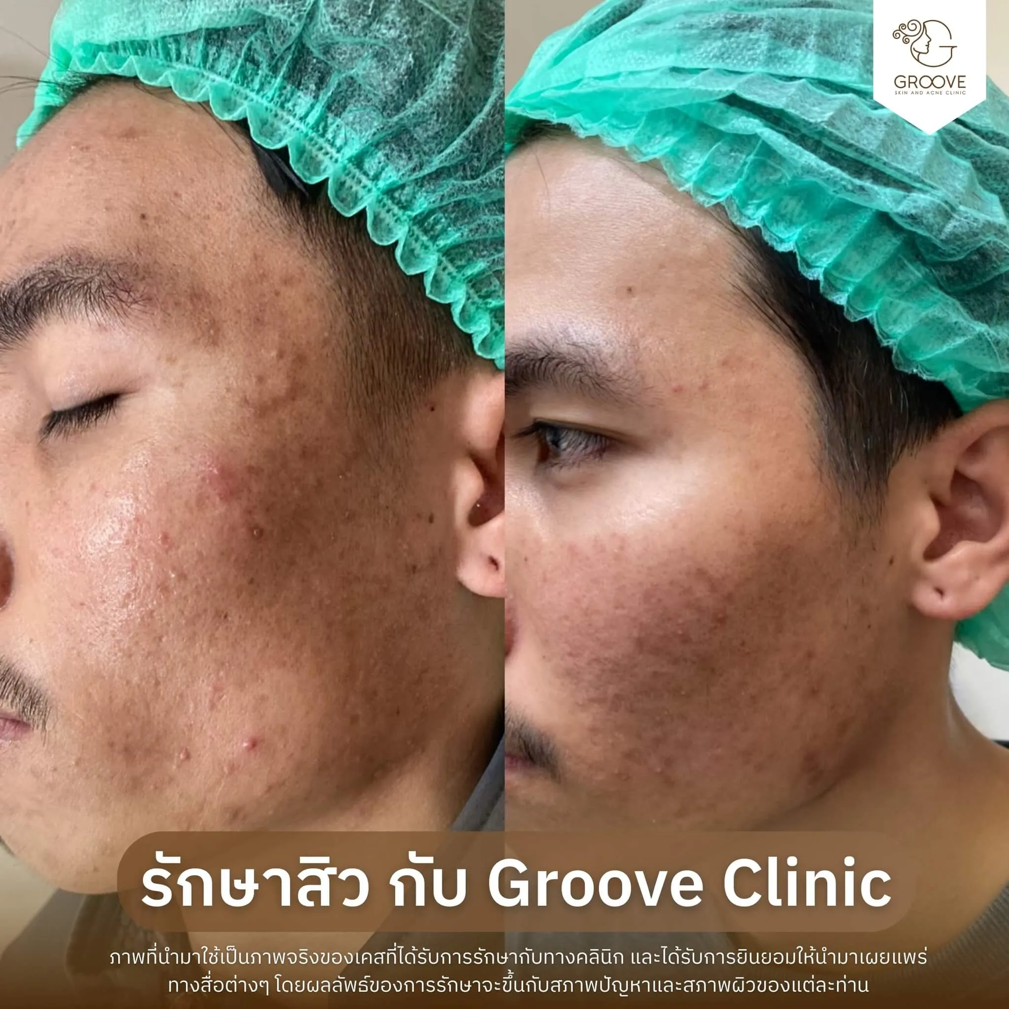 Before–After 10