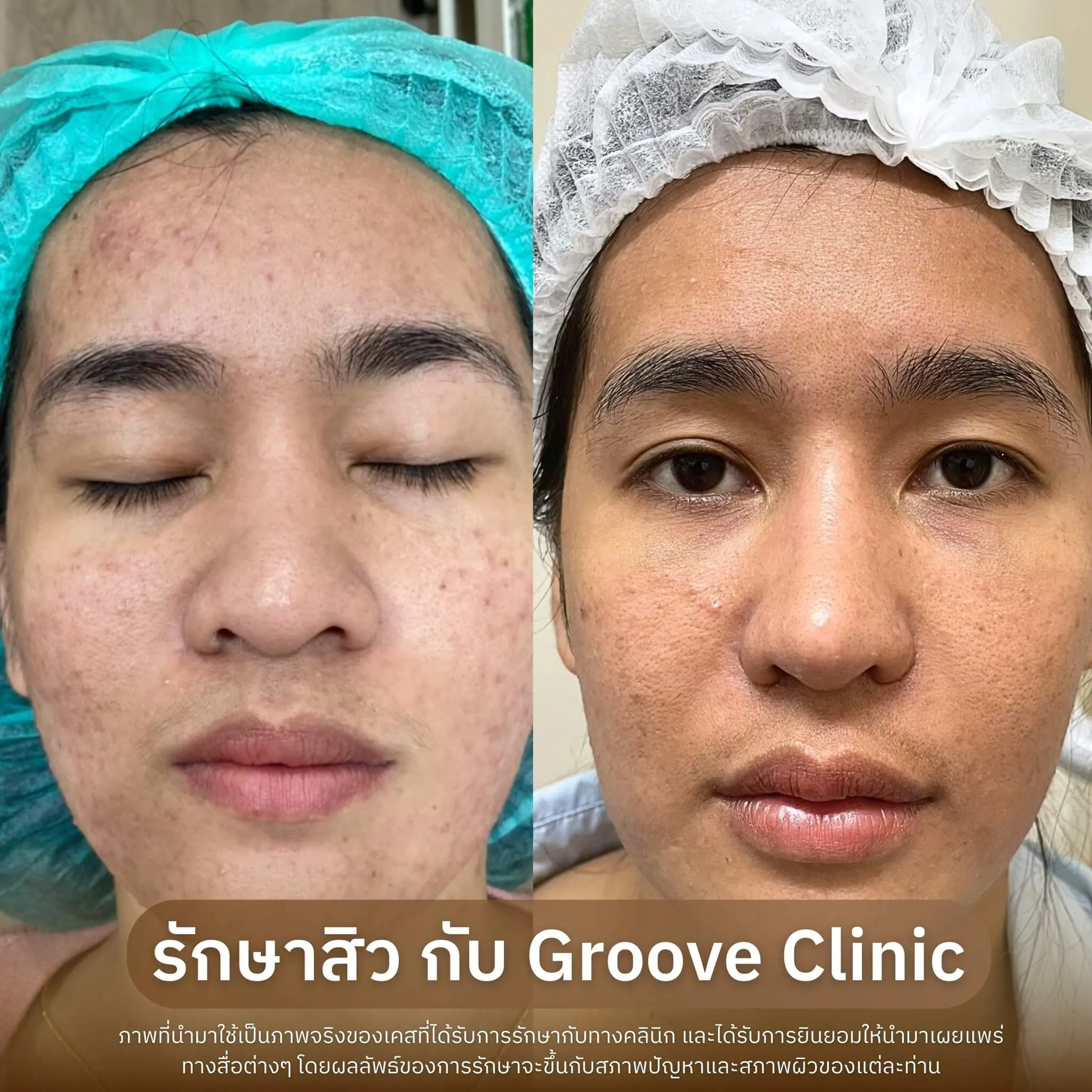 Before–After 11