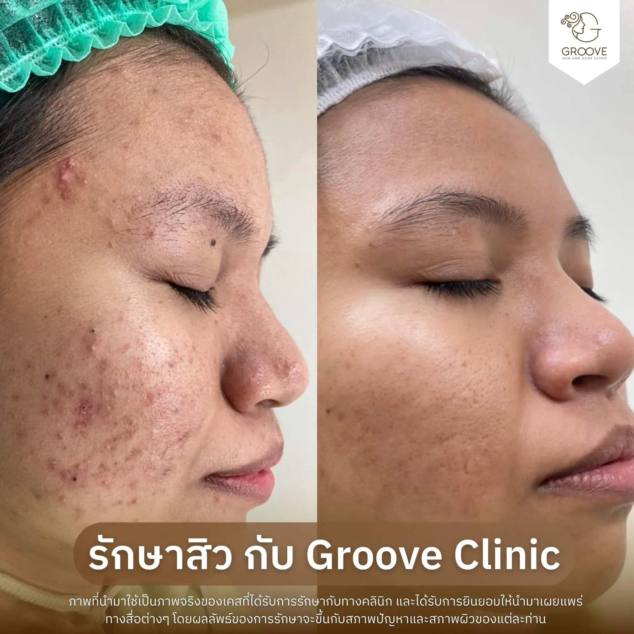 Before–After 12