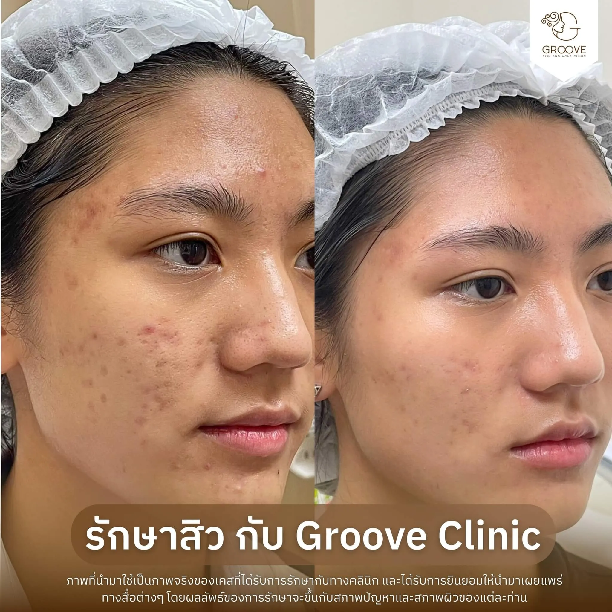 Before–After 1