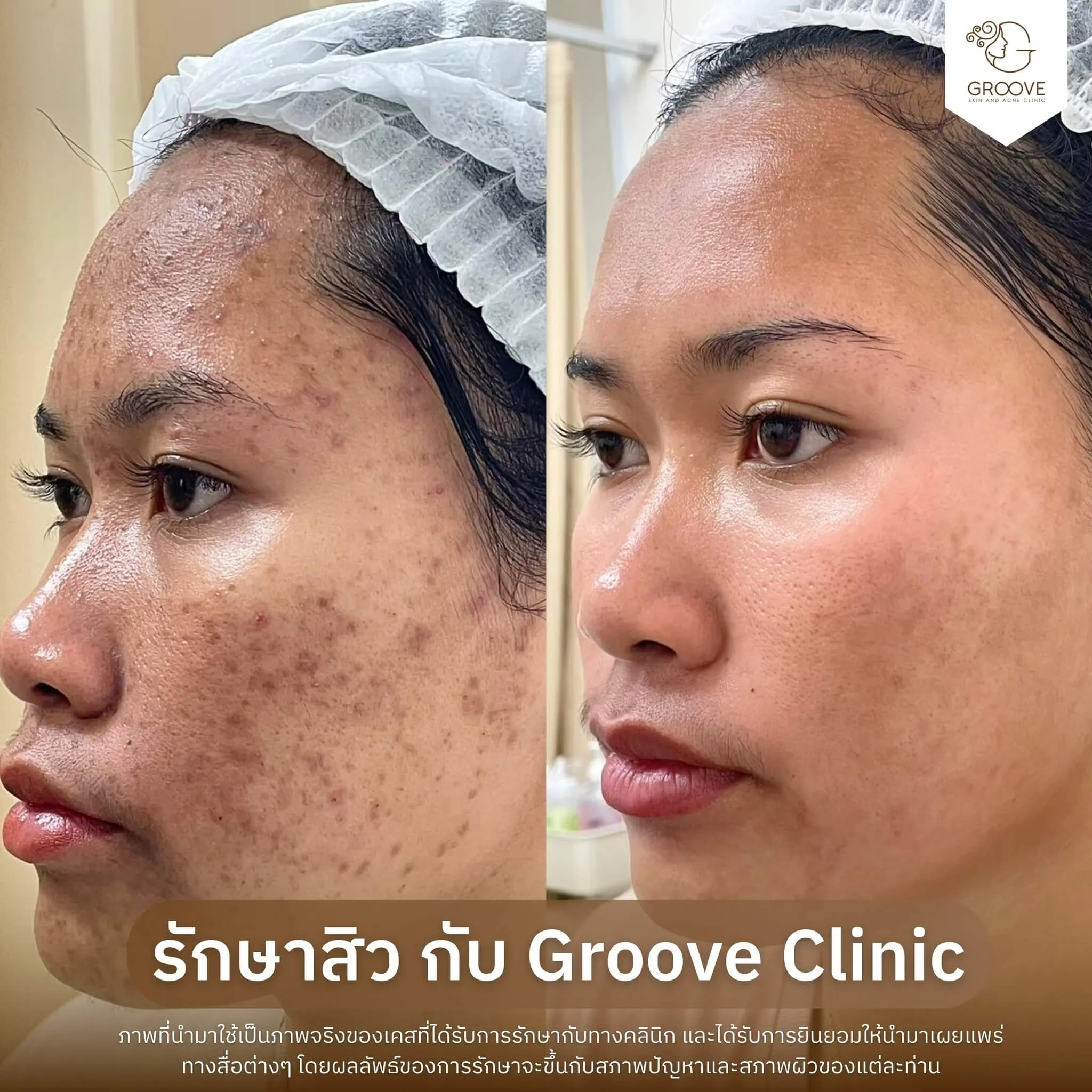 Before–After 3