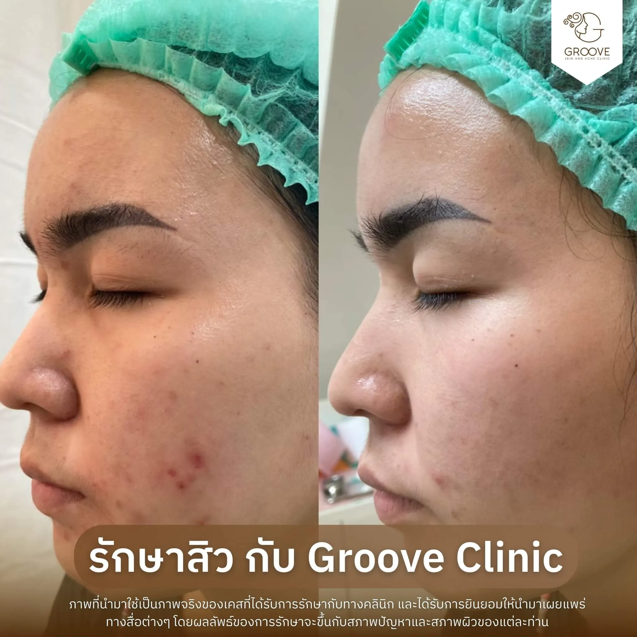 Before–After 4