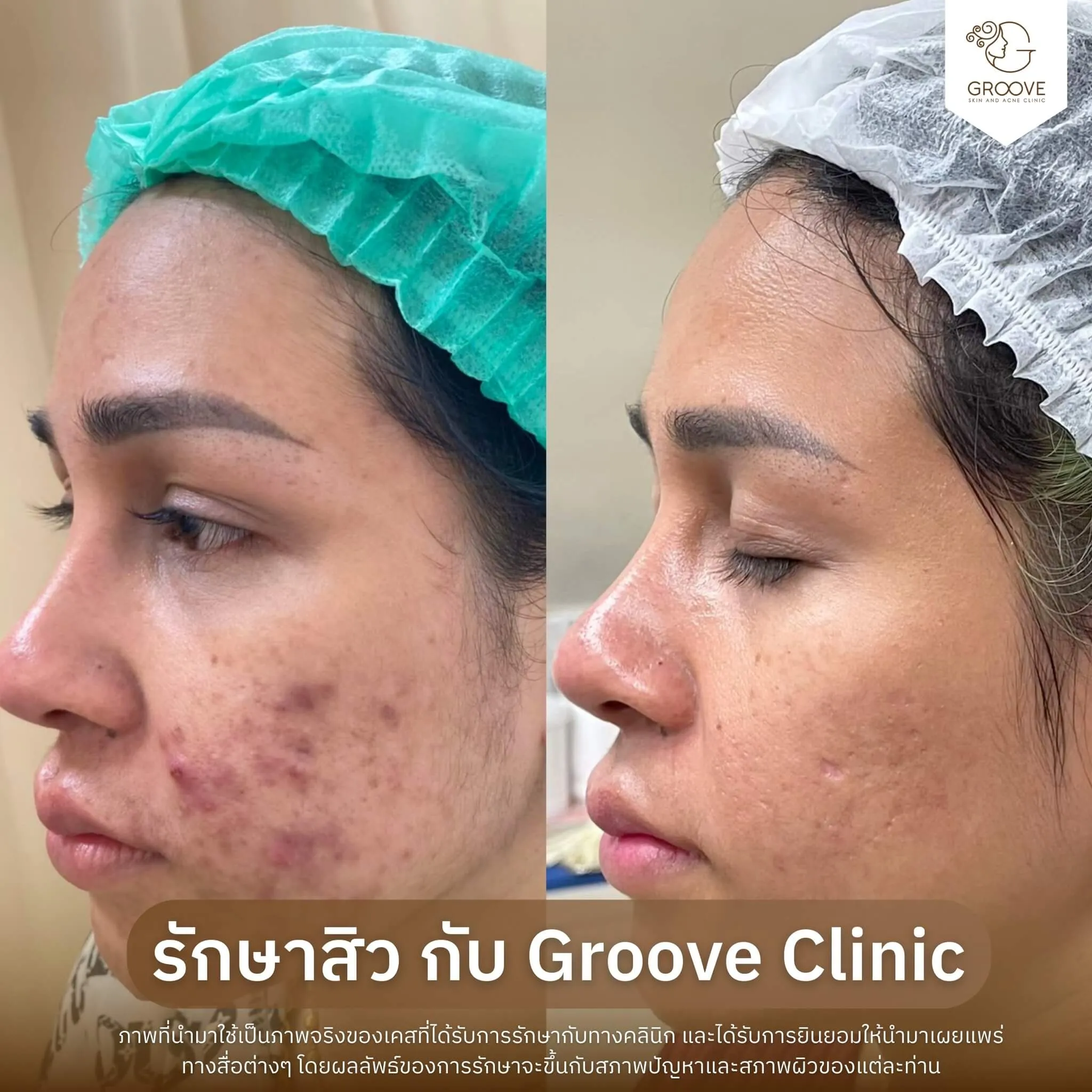 Before–After 5