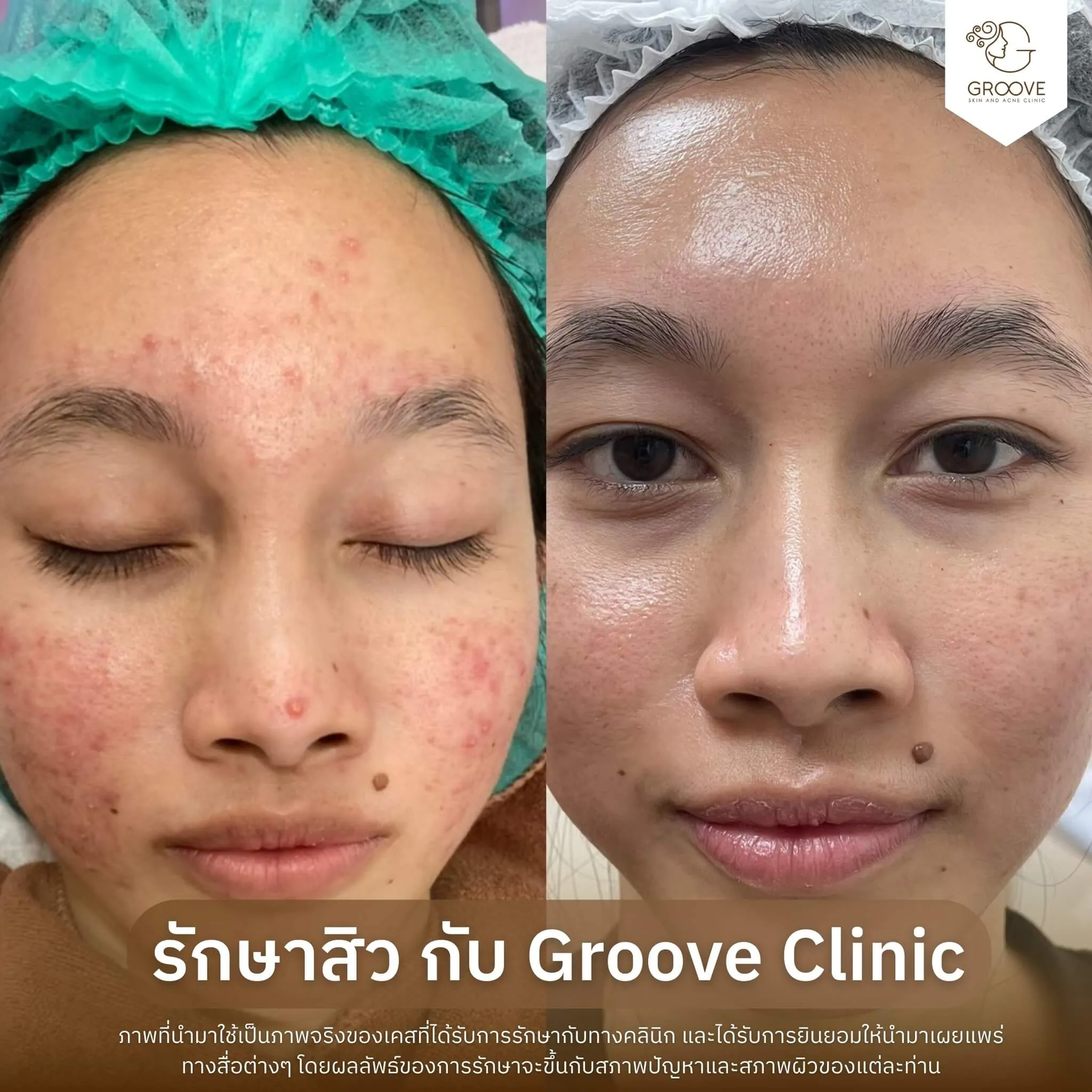 Before–After 7