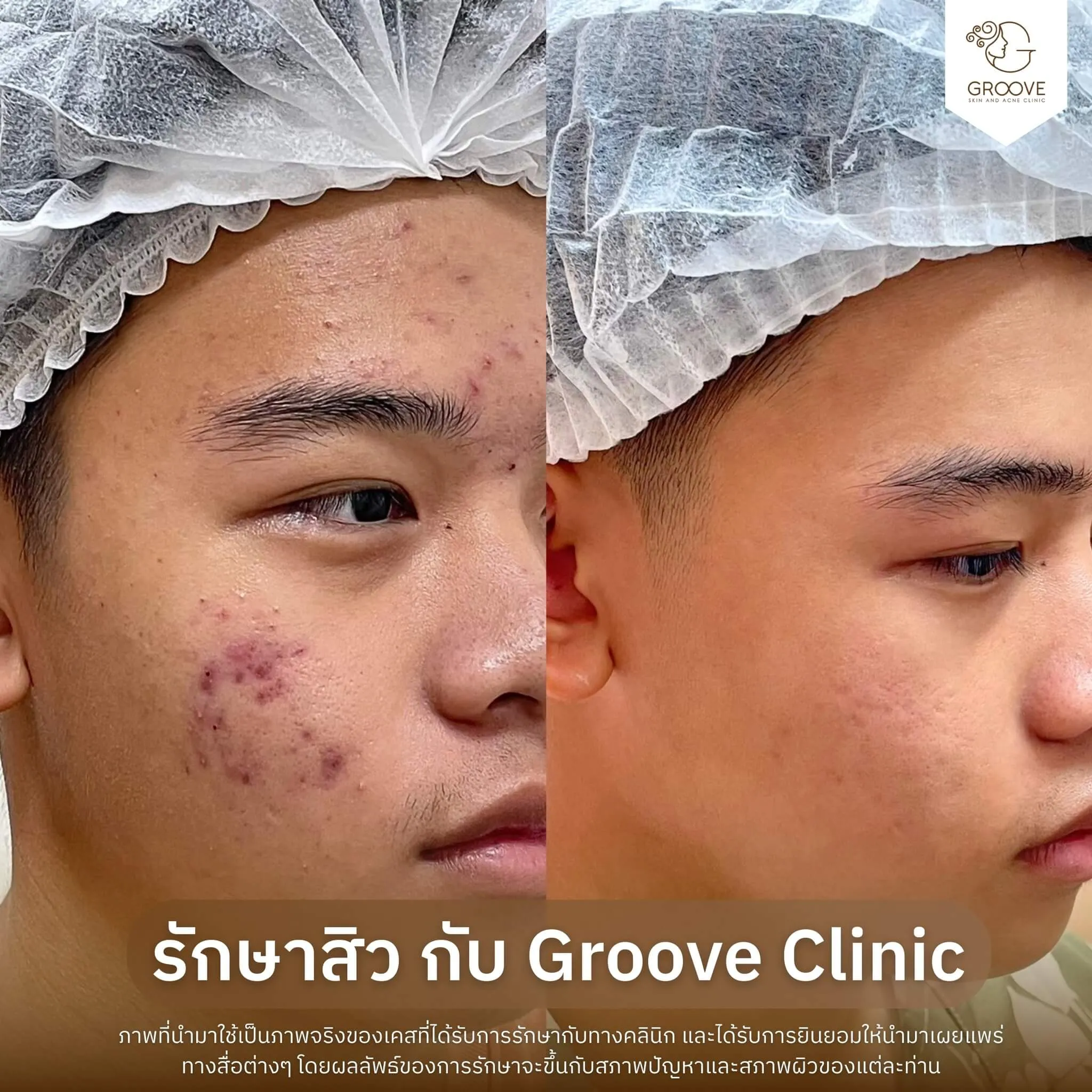Before–After 8