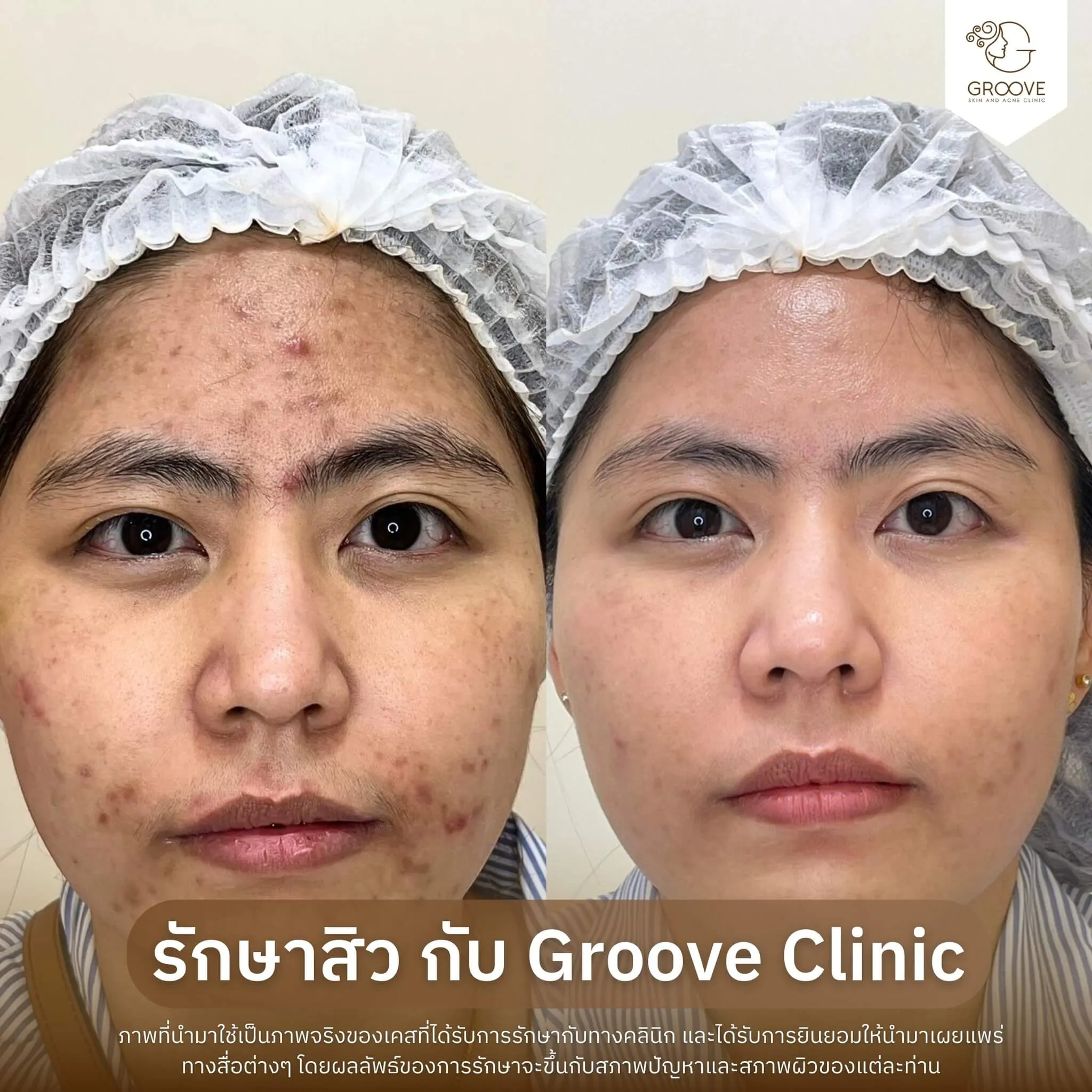 Before–After 9
