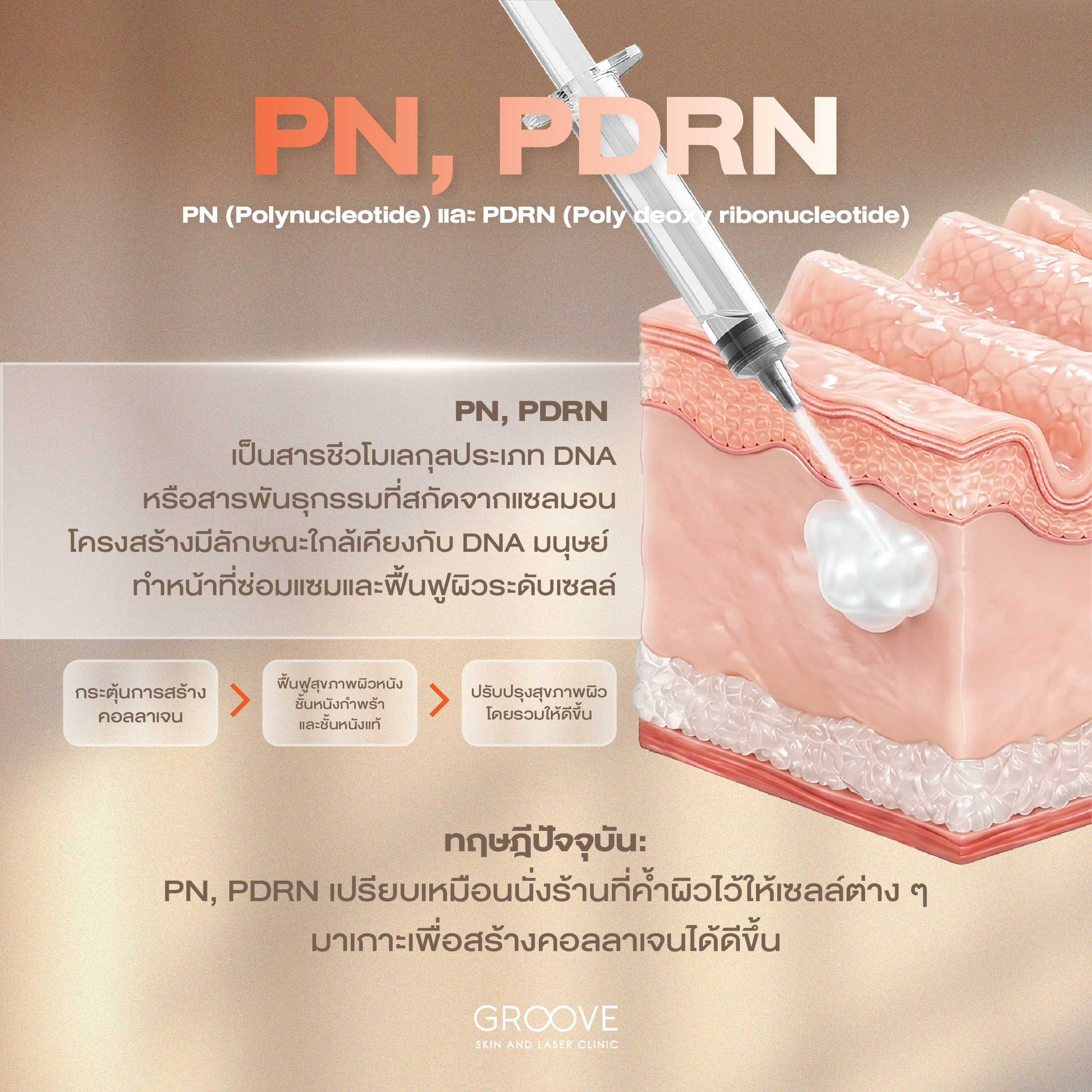 PN PDRN Polynucleotide รักษาหลุมสิว