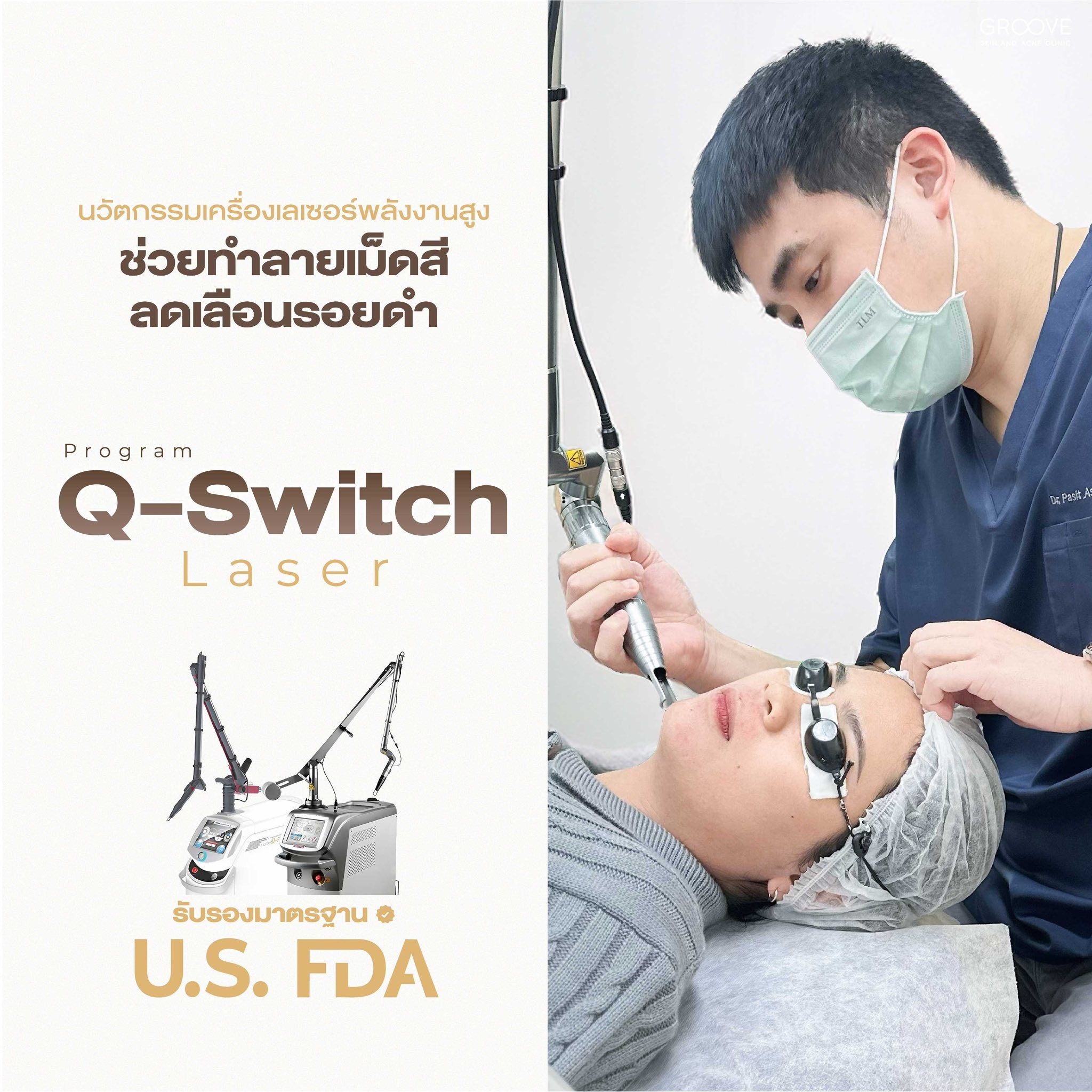 Q-Switch Laser ทำลายเม็ดสี ลดรอยดำ — Groove Skin Clinic