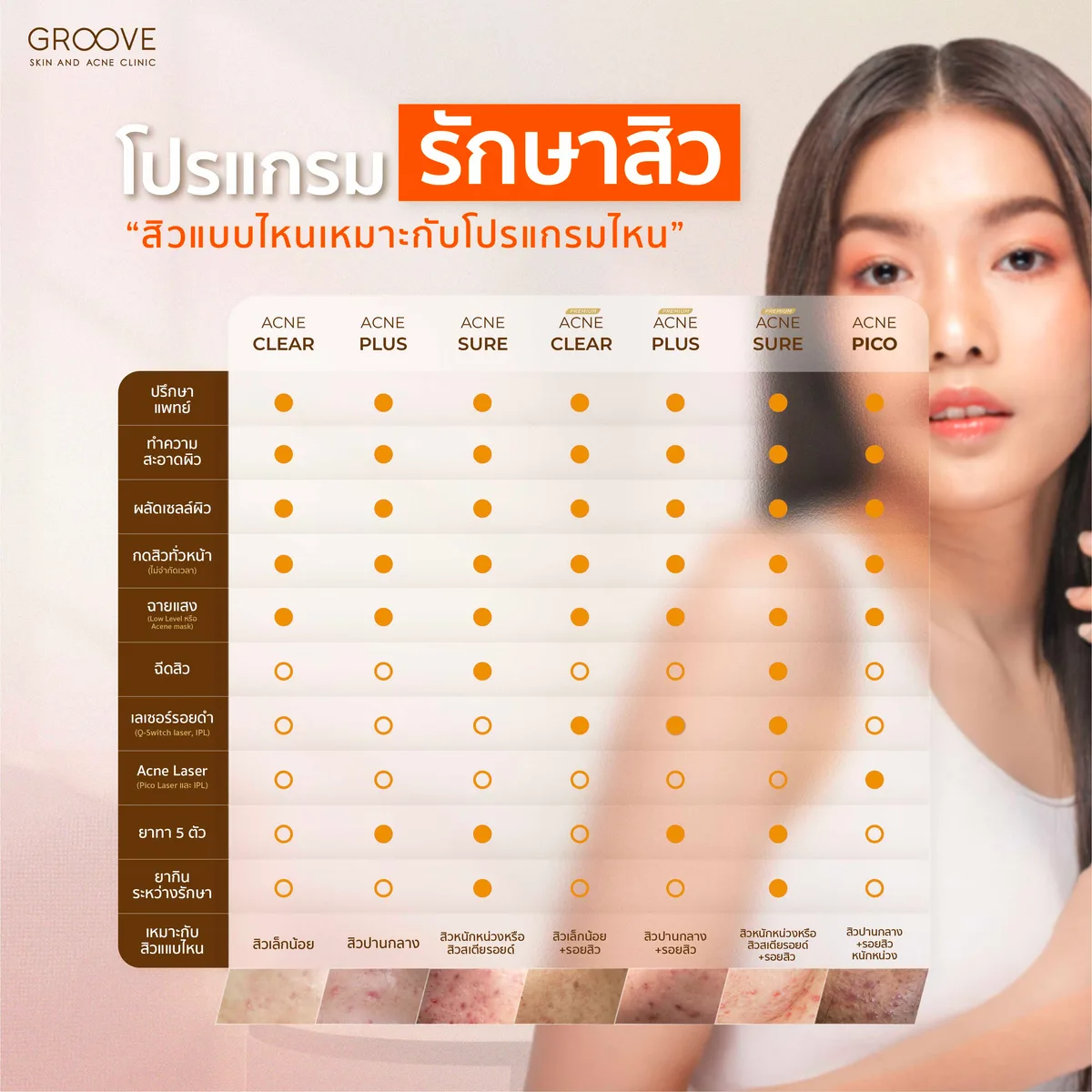 ตารางโปรแกรมการรักษาสิว — Groove Skin & Laser Clinic