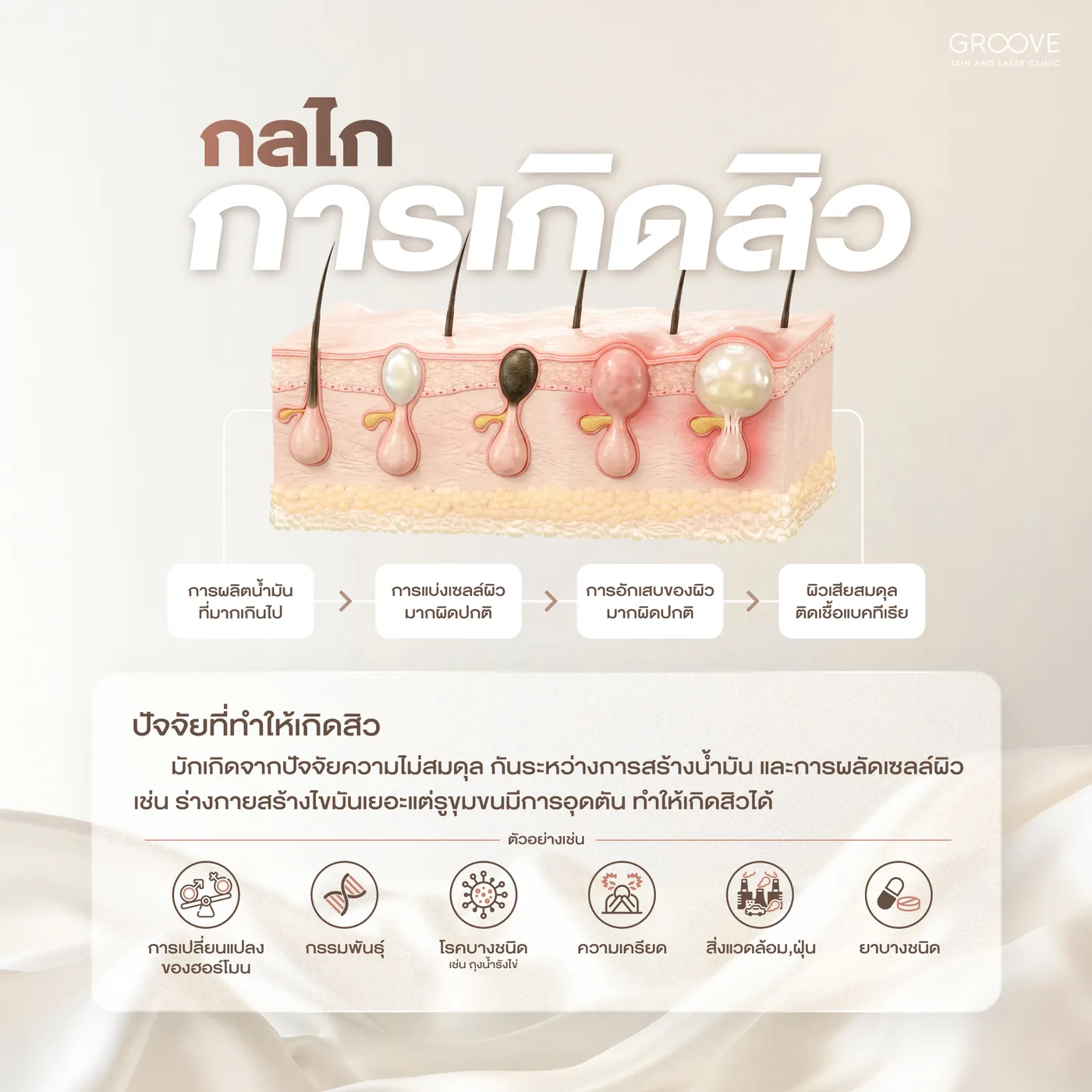 กลไกและสาเหตุการเกิดสิว — Groove Skin & Laser Clinic