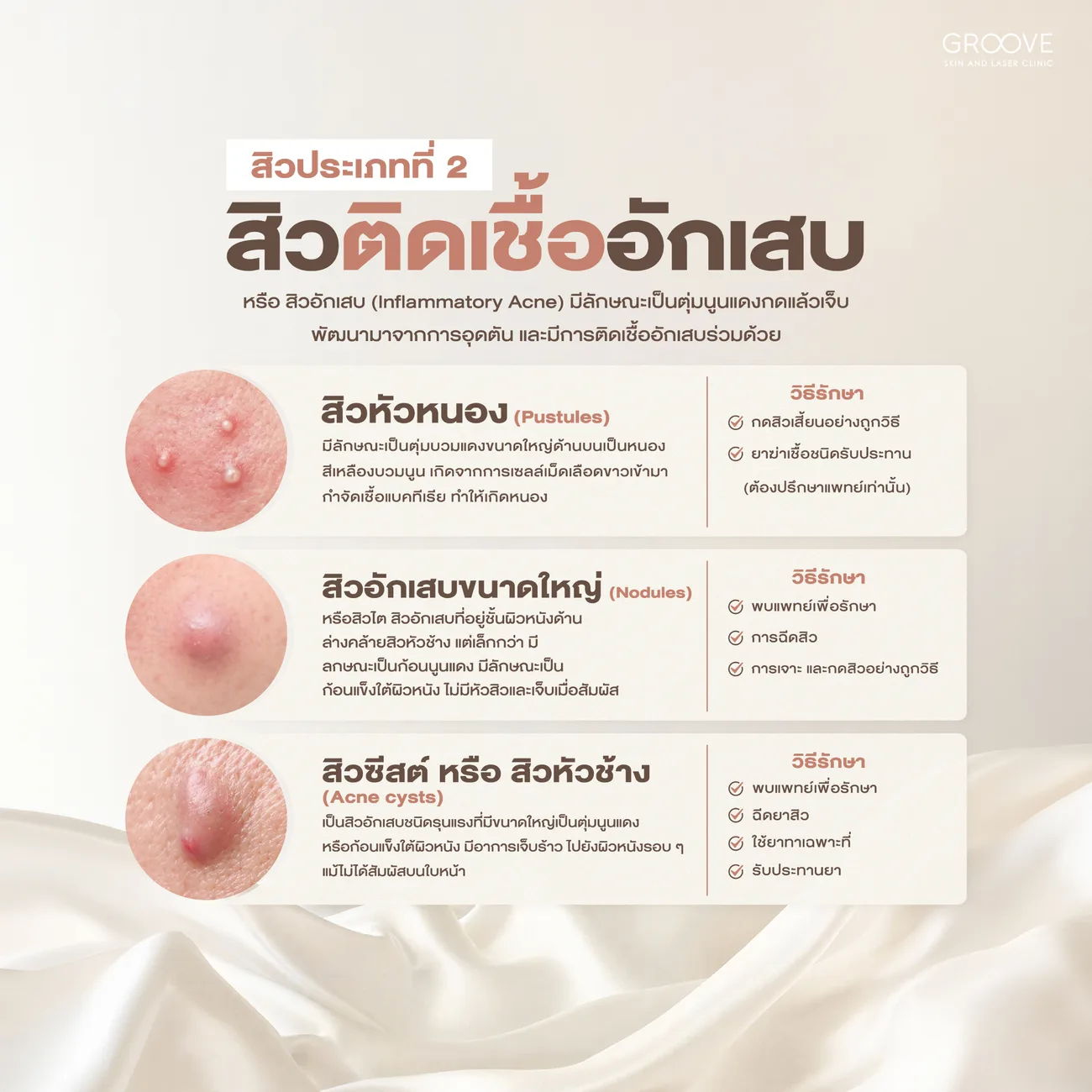 สิวกลุ่มอักเสบ สิวหัวหนอง สิวอักเสบขนาดใหญ่ สิวซีสต์ — Groove Skin & Laser Clinic