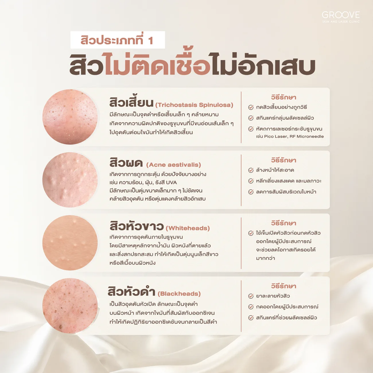 สิวกลุ่มไม่อักเสบ สิวเสี้ยน สิวผด สิวหัวขาว สิวหัวดำ — Groove Skin & Laser Clinic