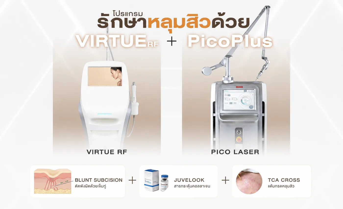 โปรแกรมรักษาหลุมสิว Virtue RF + PicoPlus — Groove Skin & Laser Clinic
