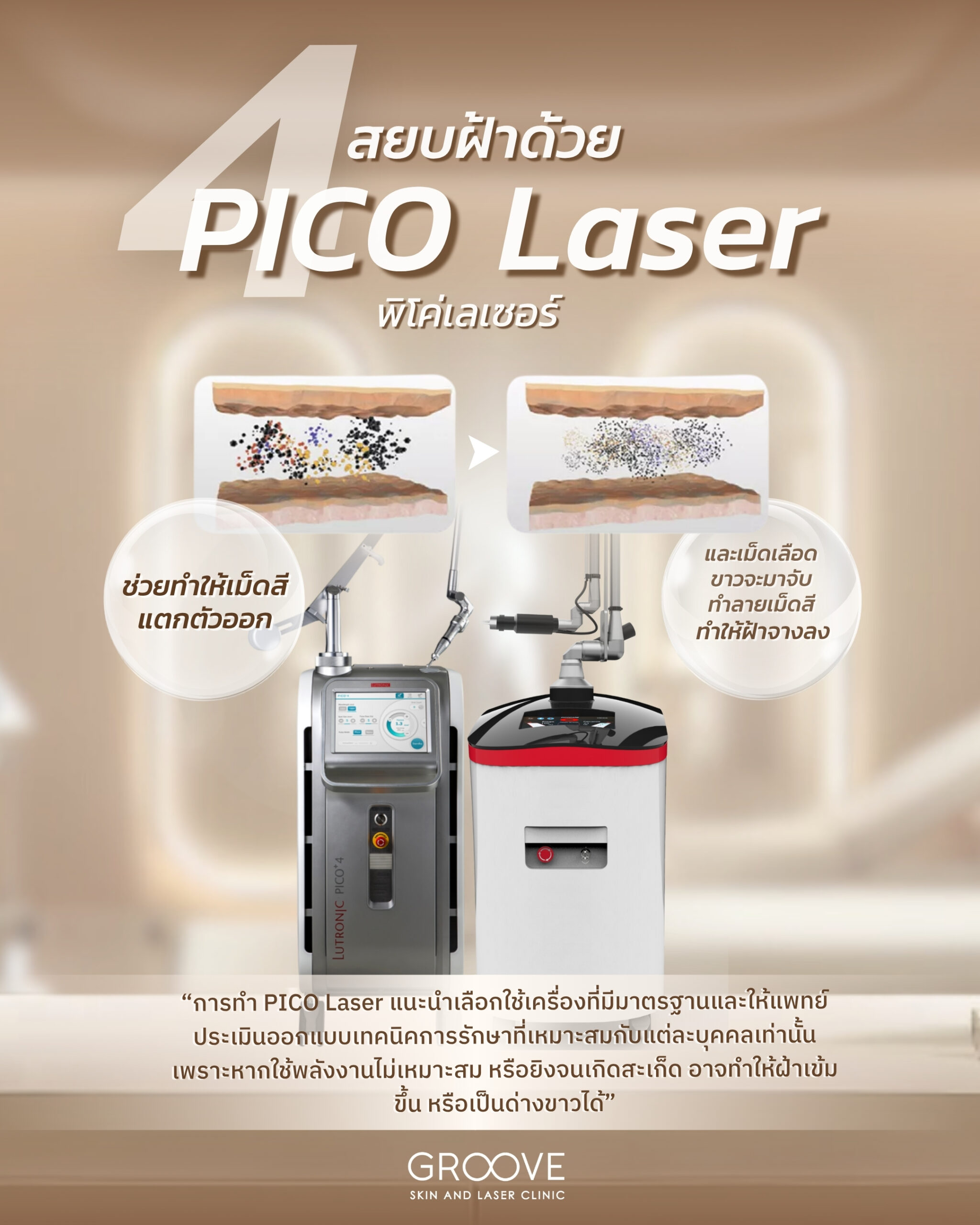 Pico Laser