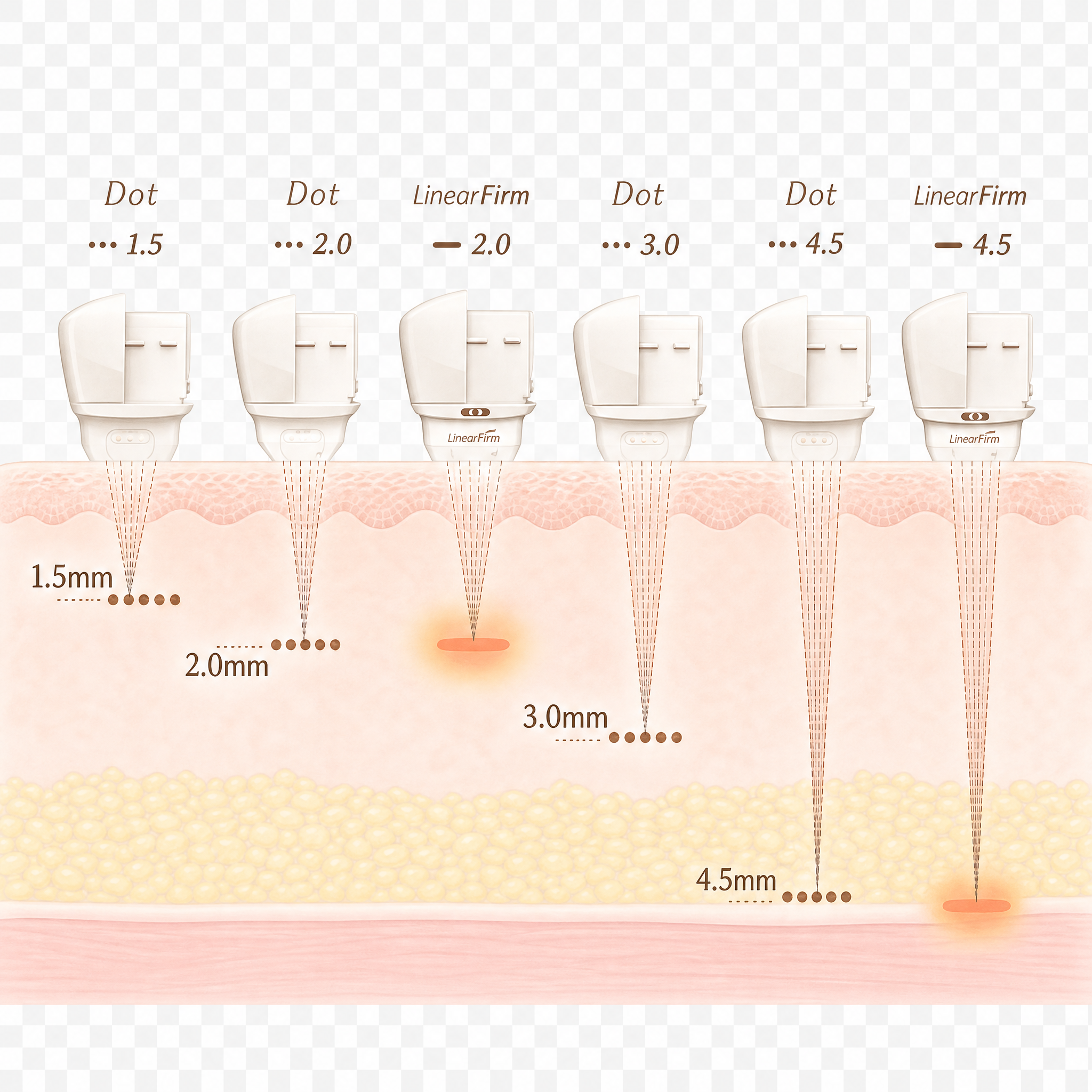 ความลึกของแต่ละชนิดหัวของ Ultracel