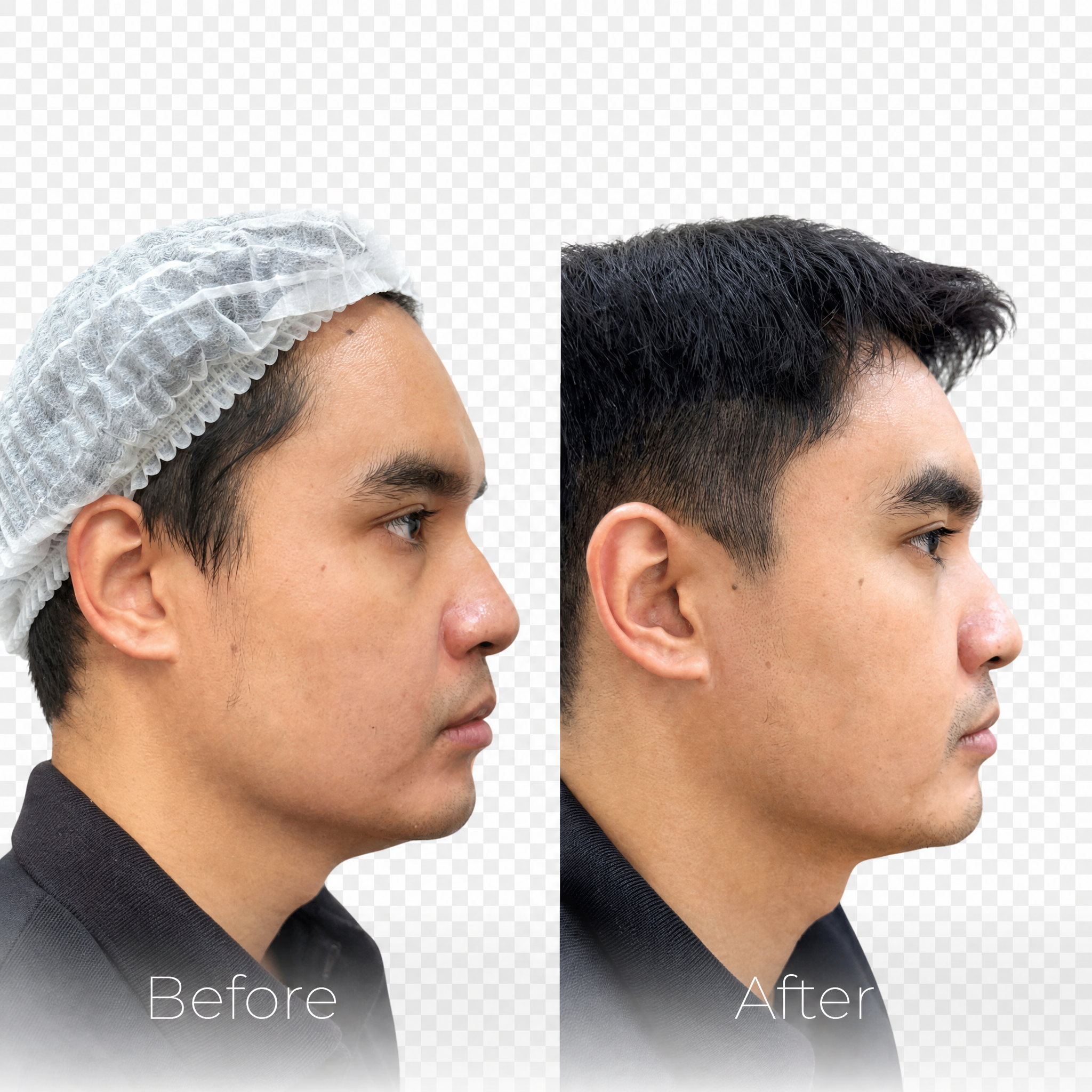 Before&after2