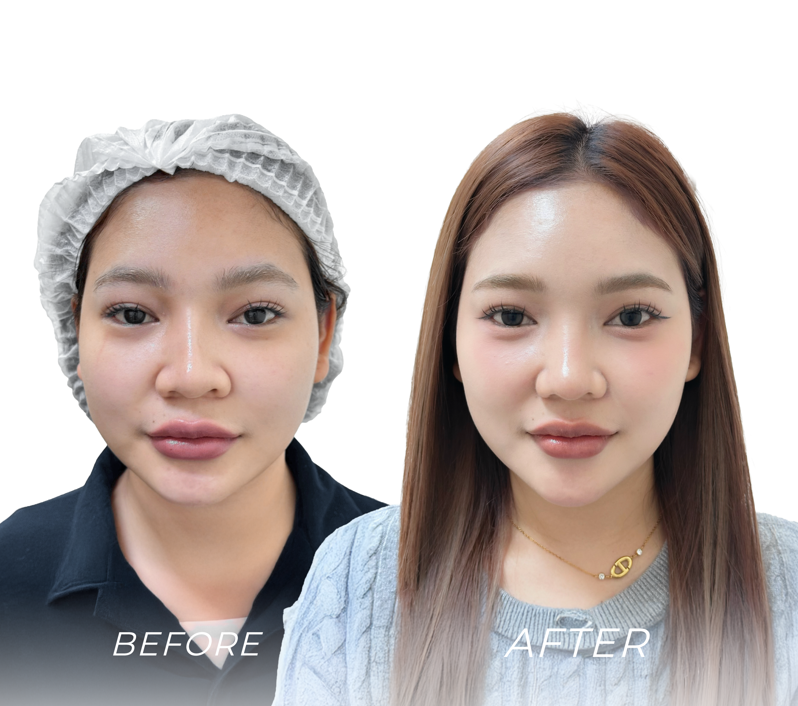 Before&after1